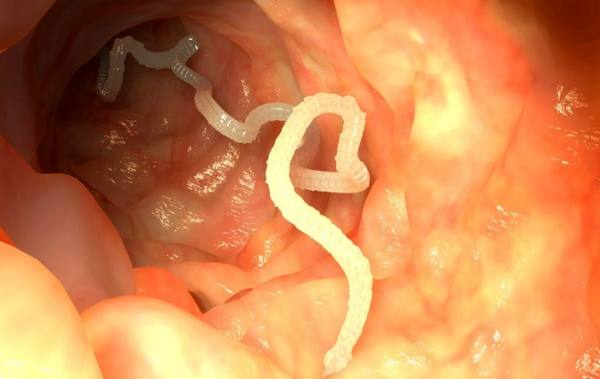 Ленточные черви в кишечнике 