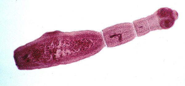паразит эхинококк