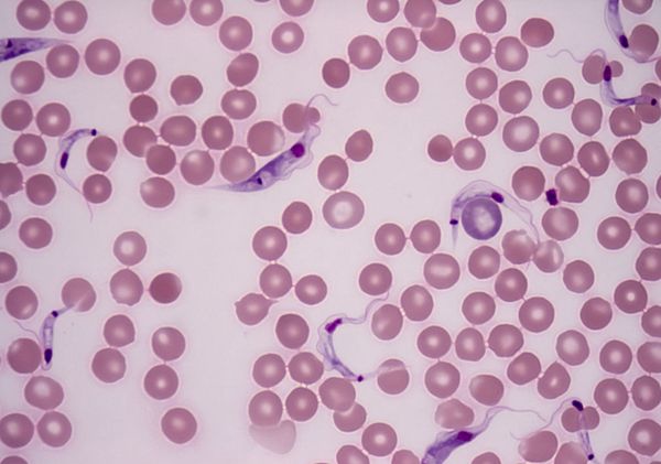 паразиты живущие в крови