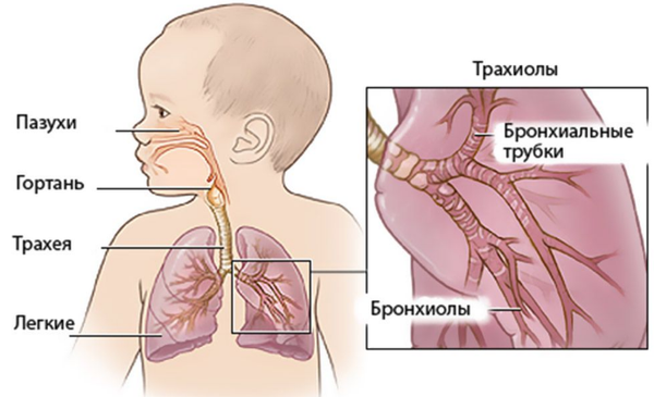 Хламидийная пневмония у детей