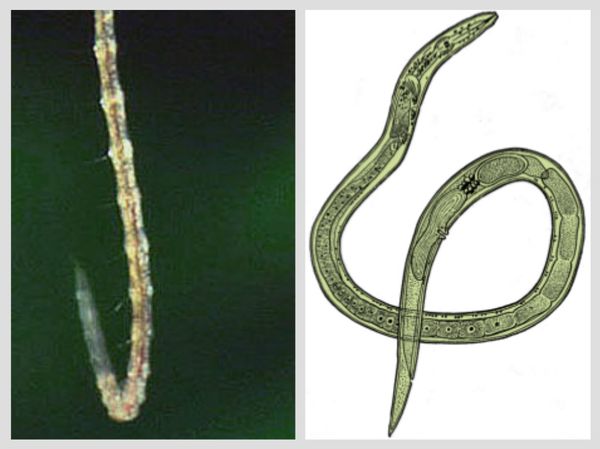 К какому типу животных относят аскариду. Аскариды у детей под микроскопом. Аскарида человеческая царство. Аскариды двуполые организмы.