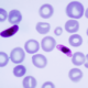Какие паразиты могут находиться в крови больного человека, и чем опасна малярия